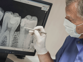 Root Canal Examination process at West SoHo Dentistry