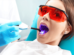 Tooth Colored Fillings Services at West SoHo Dentistry